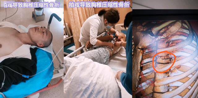 zhu shifeng kecelakaan saat syuting film ride on - Aktornya Kecelakan Saat Syuting, Kru Film Jackie Chan 'Ride On' Tak Diganti Rugi? zhu shifeng kecelakaan saat syuting film ride on