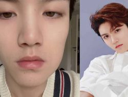 didi ling chao - Didi Ling Chao ONER Alami Radang Gigi Bungsu Hingga Bengkak Didi Ling Chao ONER Alami Radang Gigi Bungsu Hingga Bengkak