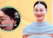 Veteran Actress Kara Wai Reveals She Had 89 Stitches on Her Face