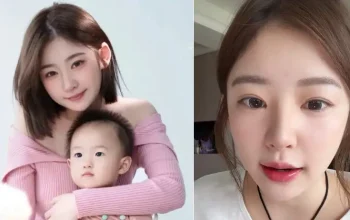 Nikita Huang Ungkap Habiskan 100 Juta Rupiah untuk Operasi Plastik - Nikita Huang Yiming Reveals Her Plastic Surgery Nikita Huang Ungkap Habiskan 100 Juta Rupiah untuk Operasi Plastik
