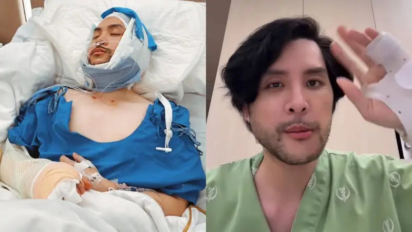 Sempat Kecelakaan Hingga Cedera Serius, Tom Isara Bagikan Kondisi Kesehatannya