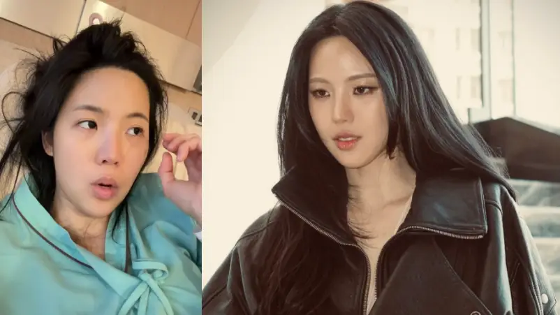Janis Janistar Dirawat di Rumah Sakit Curhat Tubuh Alami Kaget Air - Janis Janistar Dirawat di Rumah Sakit, Curhat Tubuh Alami Kaget Air Janis Janistar Dirawat di Rumah Sakit, Curhat Tubuh Alami Kaget Air