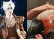 Joker Xue Ungkap Alami Kerusakan Rambut Hingga Sebabkan Rontok