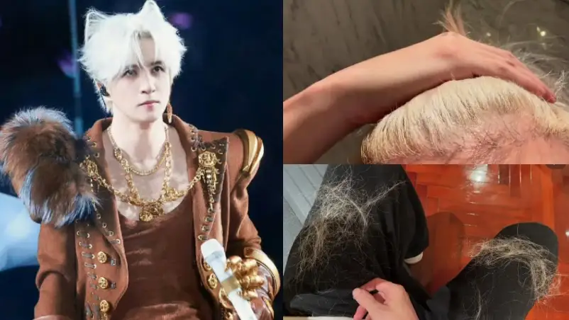 Joker Xue Ungkap Alami Kerusakan Rambut Hingga Sebabkan Rontok