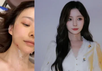 Chen Zhuoxuan Ungkap Didiagnosis Gangguan Telinga Langka - Chen Zhuoxuan Ungkap Didiagnosis Gangguan Telinga Langka Chen Zhuoxuan Ungkap Didiagnosis Gangguan Telinga Langka