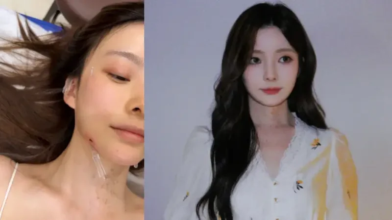 Chen Zhuoxuan Ungkap Didiagnosis Gangguan Telinga Langka