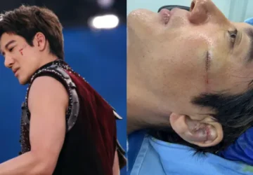 Wang Leehom Ungkap Kondisinya Terkini Usai Terjatuh saat Konser