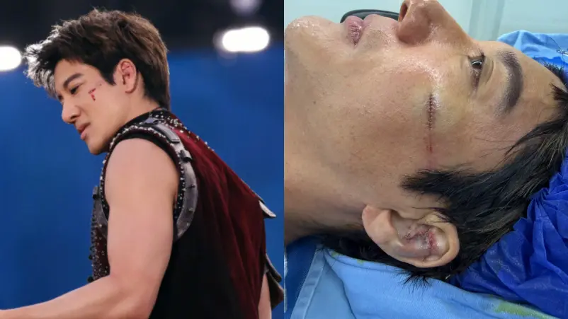 Wang Leehom Ungkap Kondisinya Terkini Usai Terjatuh saat Konser - Wang Leehom Ungkap Kondisinya Terkini Usai Terjatuh saat Konser Wang Leehom Ungkap Kondisinya Terkini Usai Terjatuh saat Konser